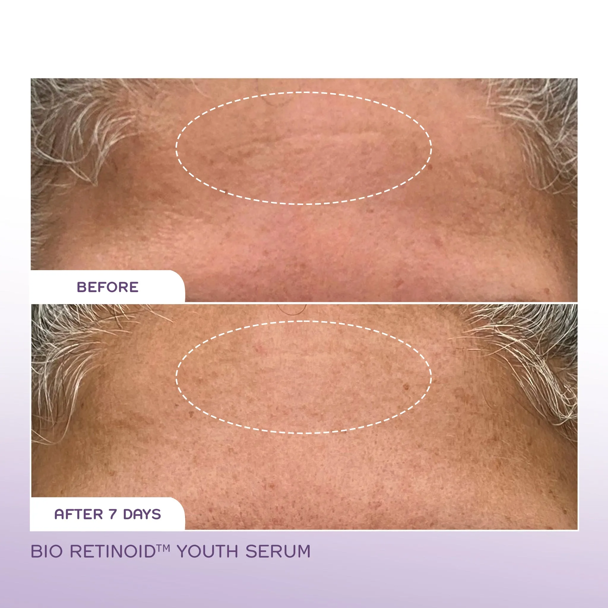 Mini Bio Retinoid™ Youth Serum