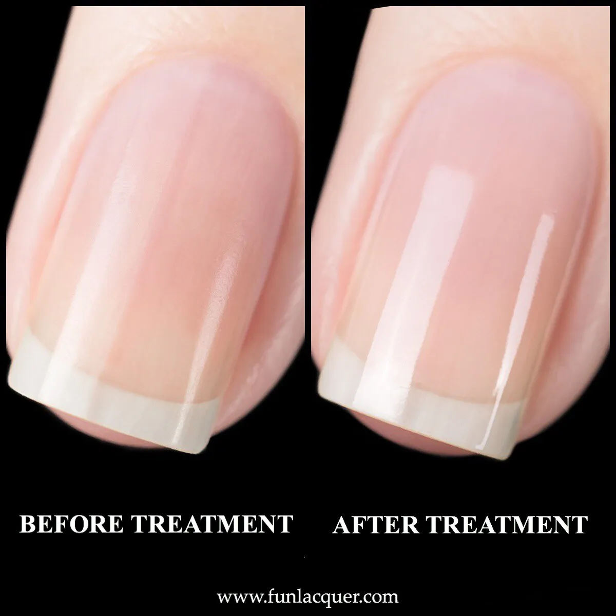 Premium Nail Treatment